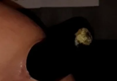 2 Huge Anal Eggplants Insertion ..big Anal Stretching!!