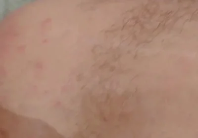 Masturbation