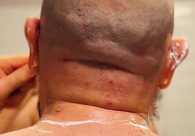 Shave Bald Head and Worship