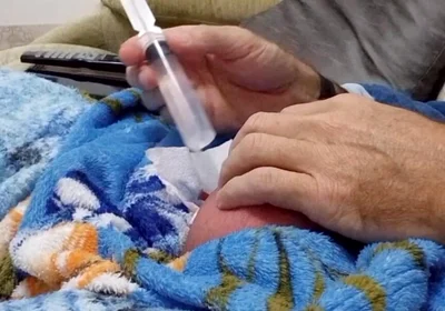 60cc Saline Injection in Each Egg