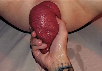 Arty Boer and Prolapsiboy.