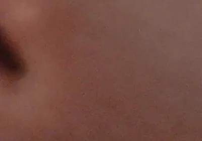 Amazing Closeup of the Widened Hole!!