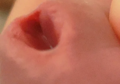 Amazing Closeup of the Widened Hole!!