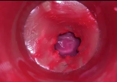 Compilation Creampie Part 7 POV