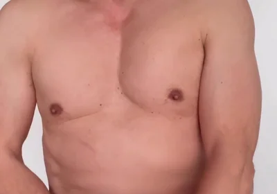 Treat with Pet Clippers.