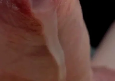 Phimosis Cock Leaking Cum Close-up Hands-free