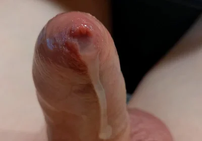 Phimosis Cock Leaking Cum Close-up Hands-free