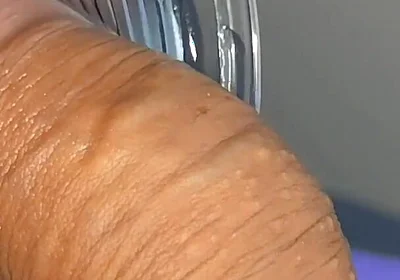 Mysterious Solution Inserted Into the Wrinkled Cock.