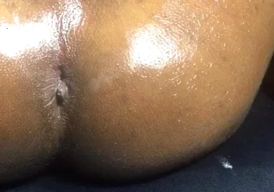 Honey Ass