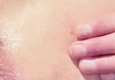 Fingering with Potato & Golf-balls
