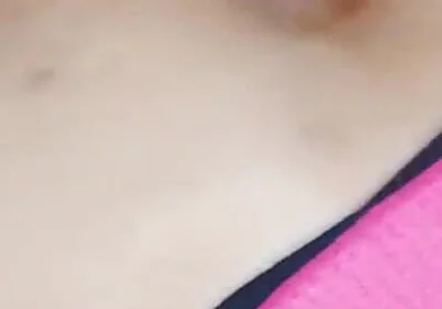 Khratos and His Fever