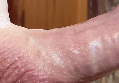 Small Hairless Virgin Phimosis Dick Braves the Cold for Some Hands-free Edging and Leaking Cum