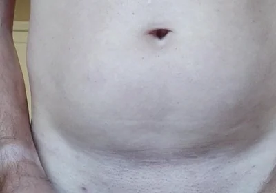 Dilatator