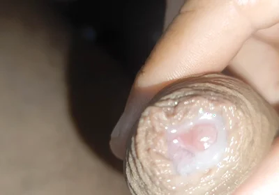 I Have the Largest Ejaculating Phimosis in the World!!