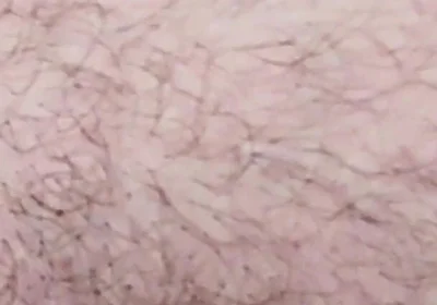 Smoking on the Fist Day 2026