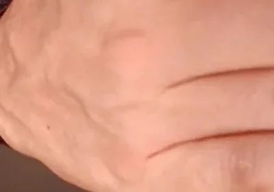 Candy in My Ass