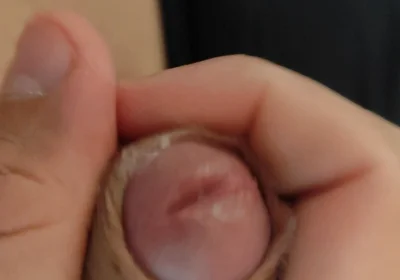 Amazing Pre Cum Glans.
