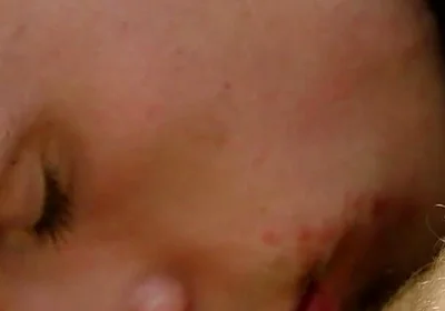 Bonus: Davey Receives 1,000 Kisses