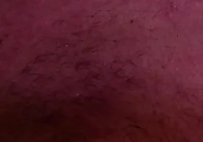 Prince Ali, Welcome to the Club