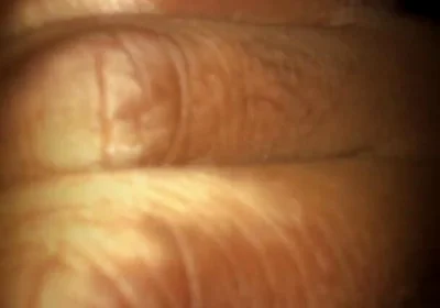 Which Angle You Like More?