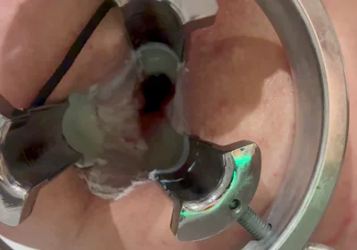 Pouring Hot Candle Wax Into Ass