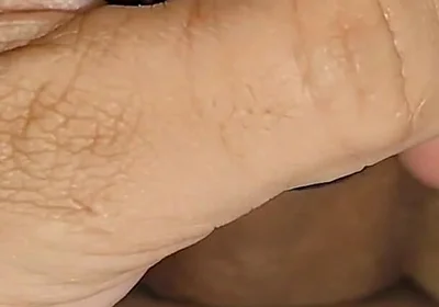 Electrical Pulsation Within the Glans with Rapid Excitation.