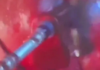 Intense Verbal Play Ahead...