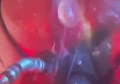 Intense Verbal Play Ahead...