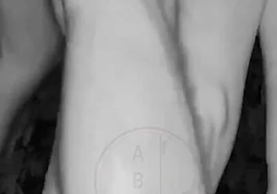 In a Park, at Night, Jules Is Desperate to Pee and Tries to Hide From His Friend but Is Caught on Night Vision Cam