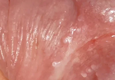 Wide Hole Filled with Pre Cum in Close up