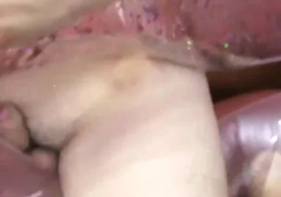 Inflatable lips