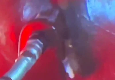 Intense Verbal Play Ahead...