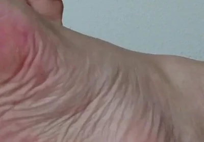 My Ugly Bare Feet in Bed