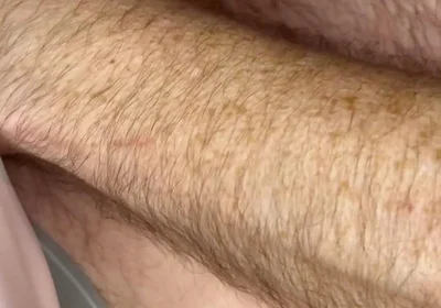 Quick Wank