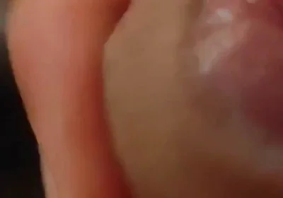 Great Phimosis Getting in the Way of the Boy's Orgasm