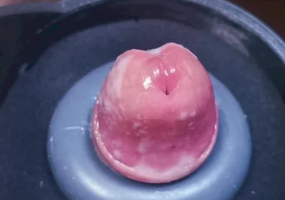 Penis Machine with a New Attachment