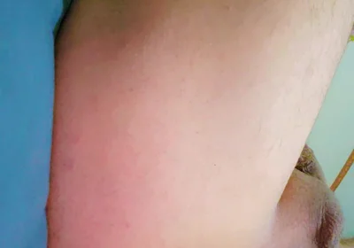 Widening the Ass Opening for Easy Orgasm.