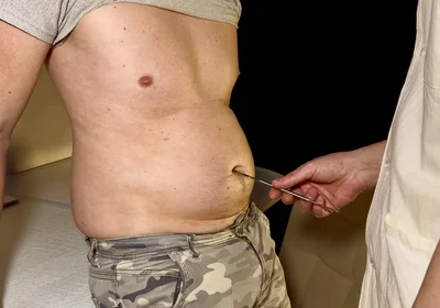 Swollen Perfection - Private Check-up