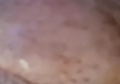 Extreme Fillings Inside My Siliconemeat