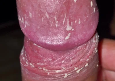 Checking My Dirty Dick