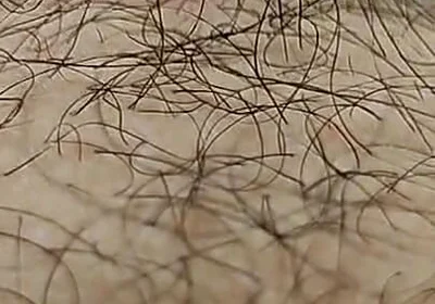 I'm Hairy Boy This My Legs and Dick