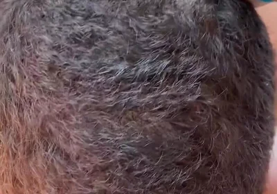 More Sucking