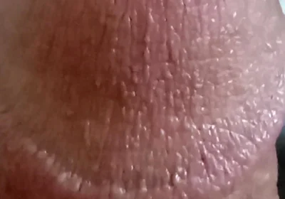 My Dick