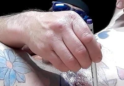 My Butt Hole Has Been Swollen Like This for 2 Days