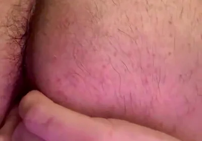 Balloon Anal Inflation