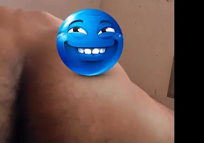 Shaving Penis Gone Wrong Burning Bushes