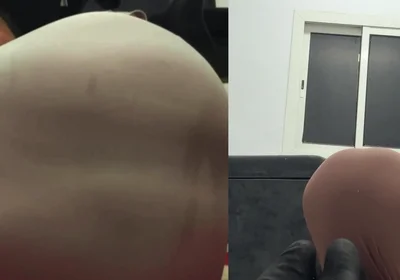 Verticalargument4tight Dress