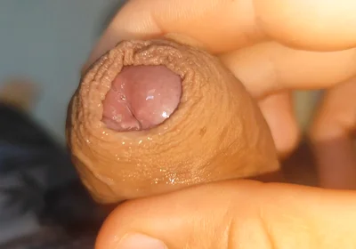 Its Source of Protein Is Already Dawning Like Rock