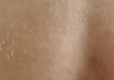 Licking Her Smooth, Wet Hole, He Started Fucking Her with Hot Cum