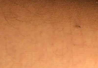 Hard Anal Fisting in Pantyhose